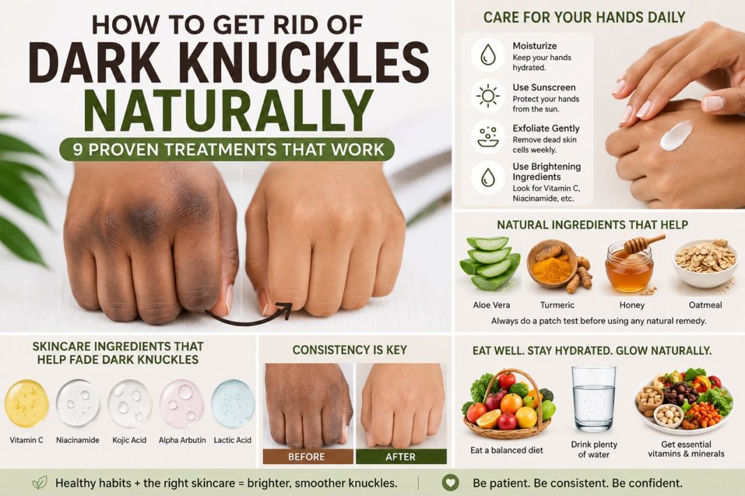 How to Get Rid of Dark Knuckles Naturally