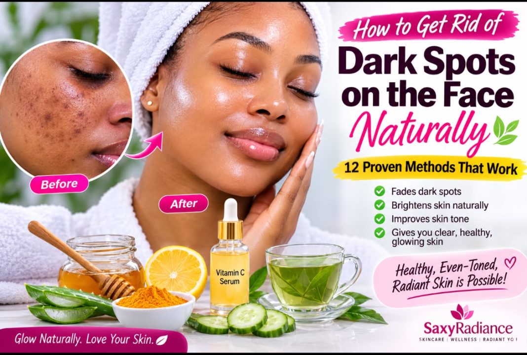 Get Rid of Dark Spots Naturally