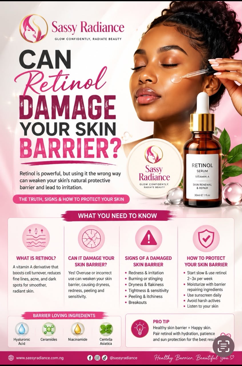 Can Retinol Damage Your Skin Barrier featured infographic with Sassy Radiance skincare and skin barrier protection tips.